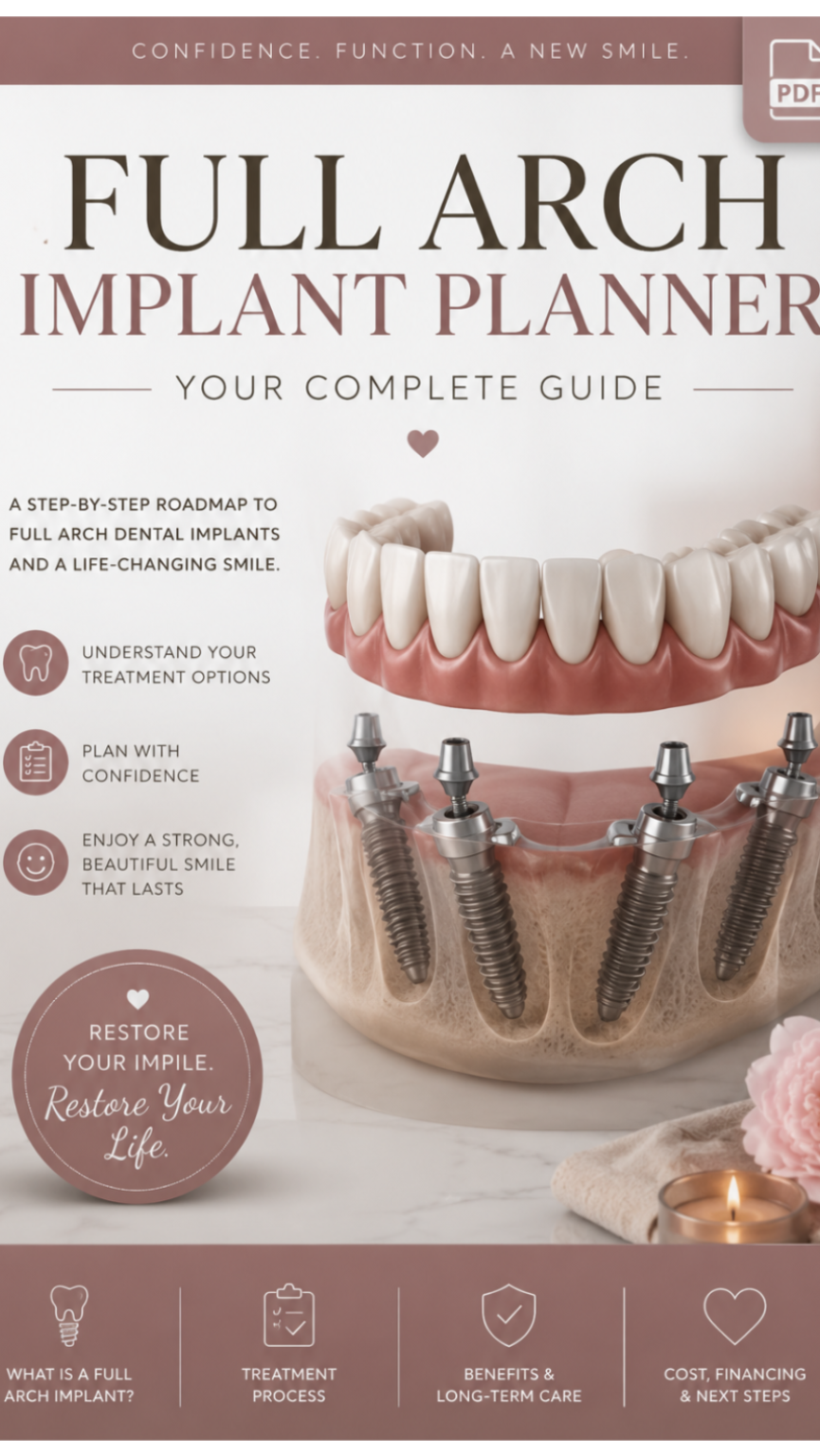 Full Arch Implant Planner Everything you need to know!
